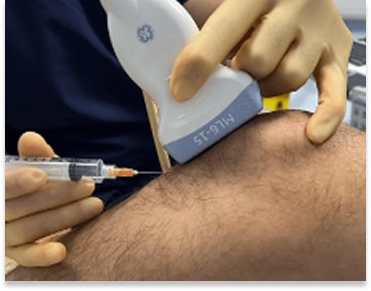 Close-up of an ultrasound probe on a knee while a needle is guided into the joint